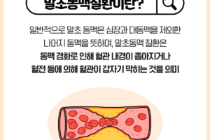 말초동맥질환, 잘못하면 다리 절단까지?